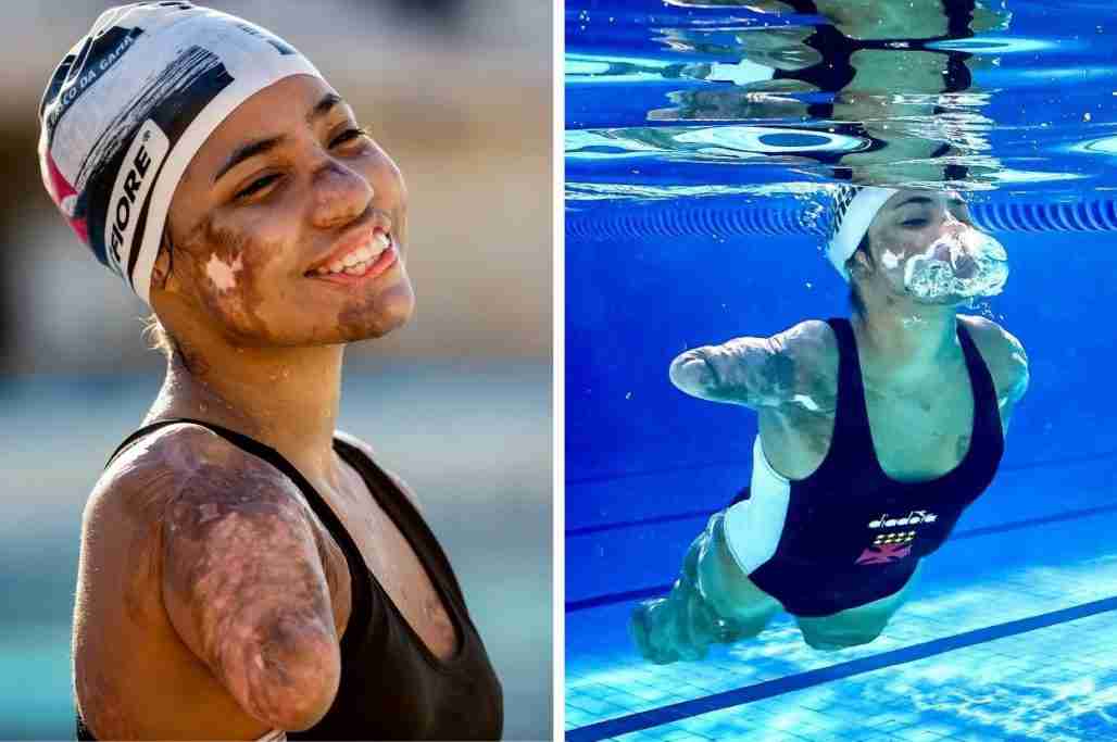 This Deaf Brazilian Teen Who Had Her Limbs Amputated Is Training To Swim At The Paralympics
