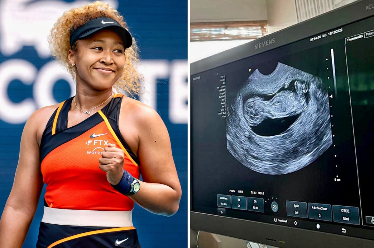 Four-Time Grand Slam Winner Naomi Osaka Has Announced She Is Pregnant With Her First Child