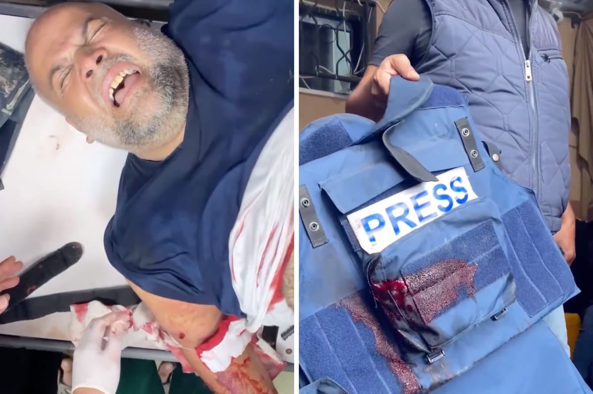 The Palestinian Journalist Whose Family Were Killed By Israeli Airstrikes Has Been Wounded By An Airstrike