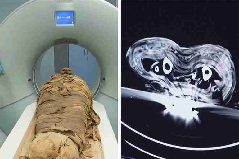 mummy ct scan italy